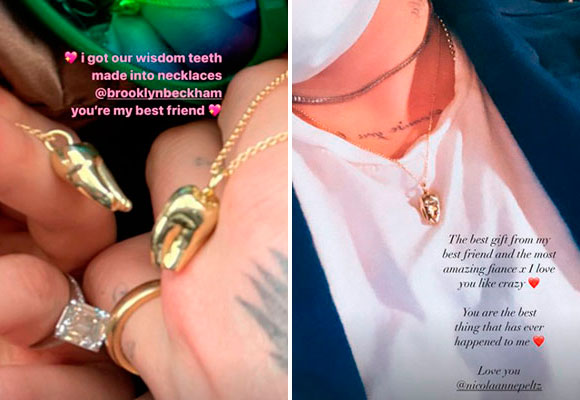 muelas brooklyn beckham y nicola peltz