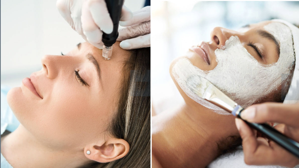 micropunción facial