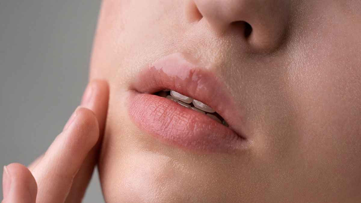 Labios